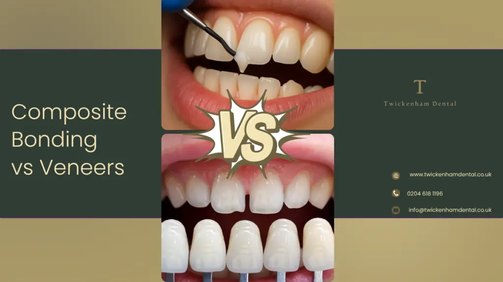 Composite Bonding vs Veneers in Twickenham – Which Is Best for Your Smile? 2026 Guide