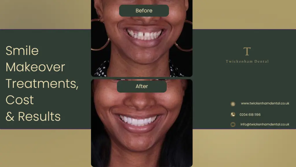 Smile Makeover in Twickenham – Treatments, Costs and Expected Results 2026 Guide