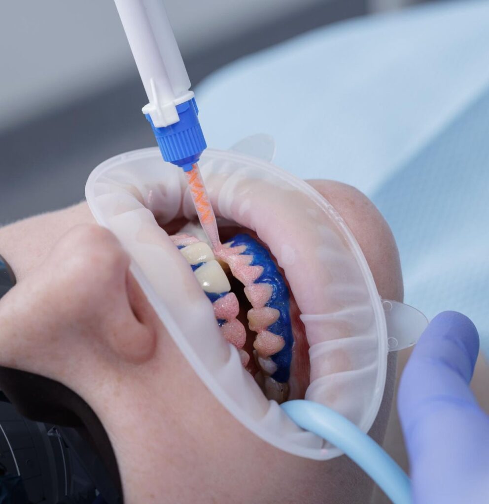 Teeth whitening treatment at cosmetic dentist in Twickenham