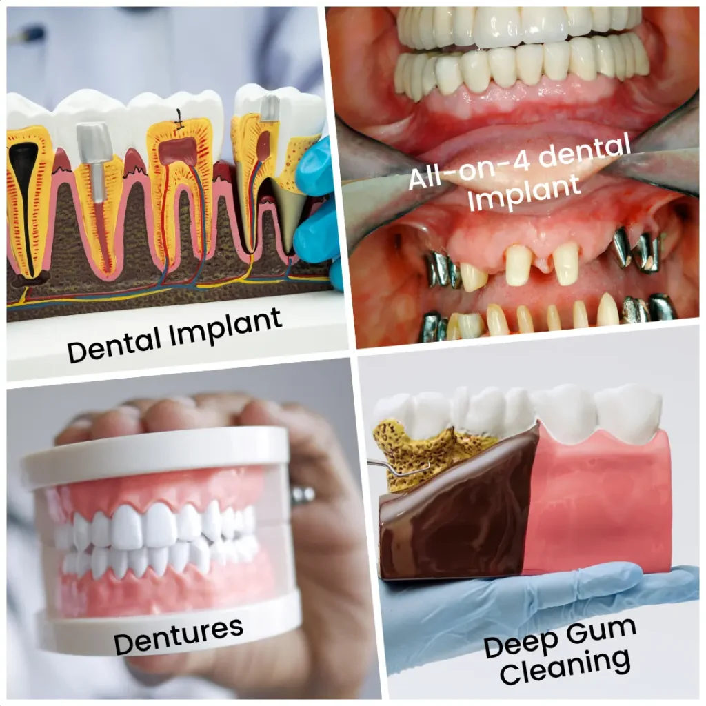 Specialist dentistry clinic in Twickenham offering dental implants, All-on-4, prosthetics and periodontic treatments
